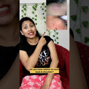 1766507626 maxresdefault