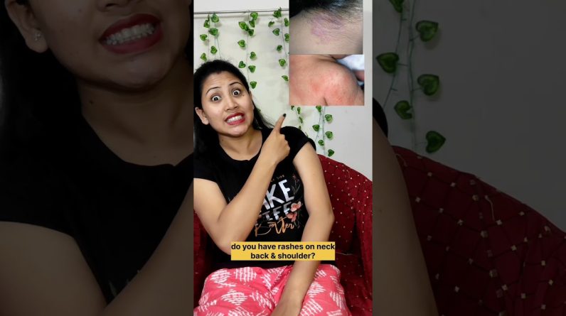 1766507626 maxresdefault