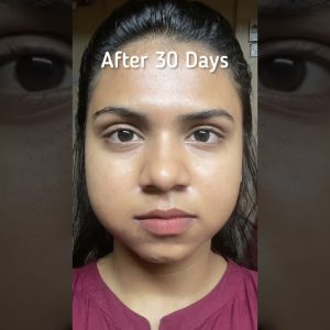 1766509964 maxresdefault