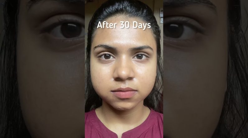 1766509964 maxresdefault