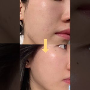 1766521064 maxresdefault