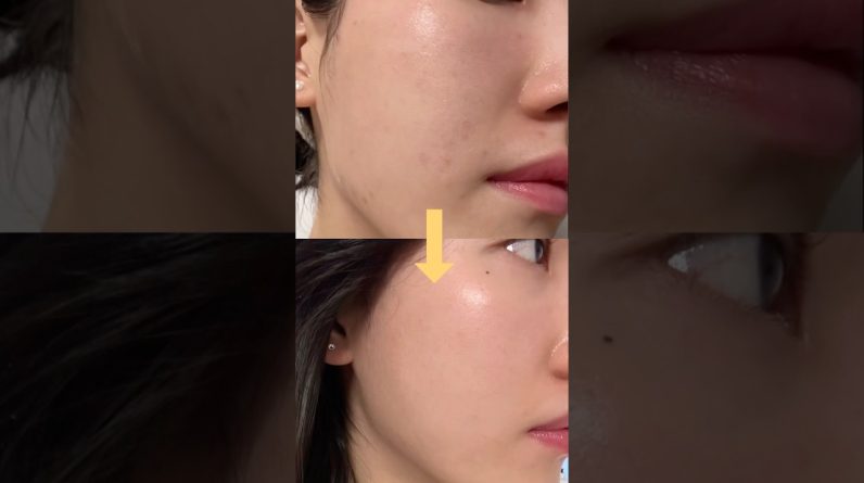 1766521064 maxresdefault