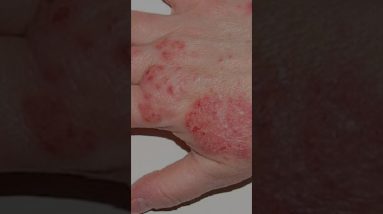 1766525024 maxresdefault