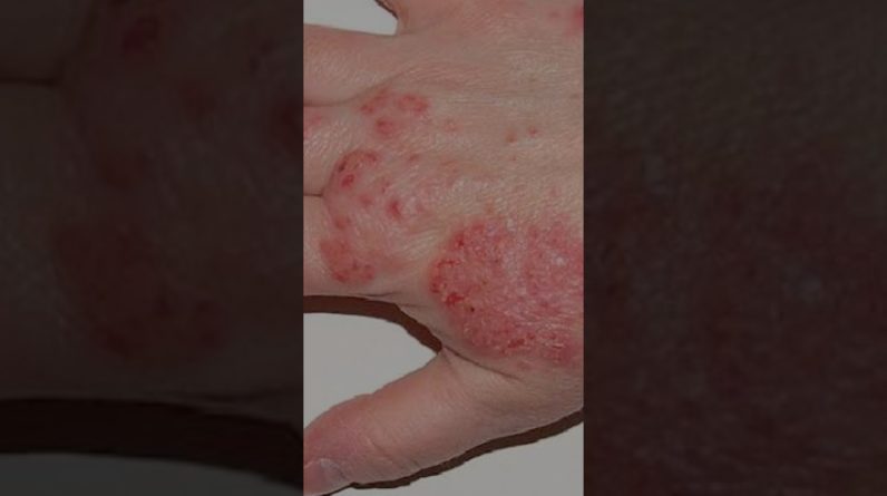 1766525024 maxresdefault