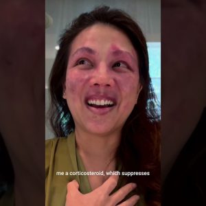 1766531923 maxresdefault