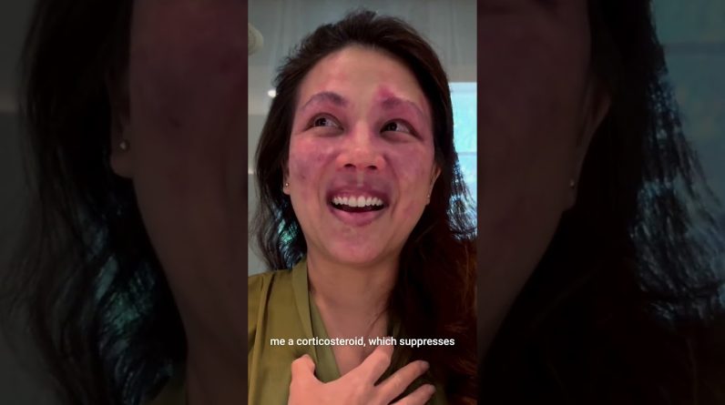 1766531923 maxresdefault