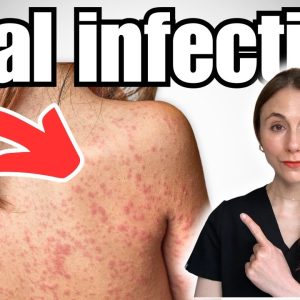 1766568527 maxresdefault