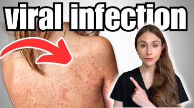 1766568527 maxresdefault