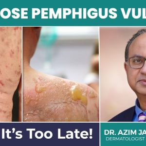 1766572184 maxresdefault