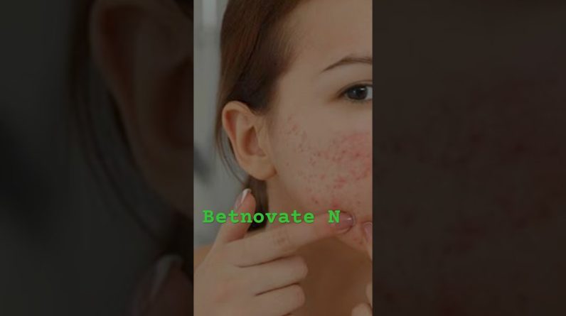 1766575964 maxresdefault