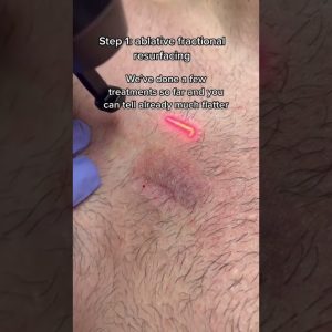 1766586920 maxresdefault