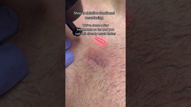 1766586920 maxresdefault