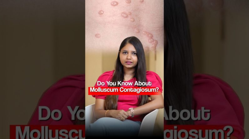 1766599184 maxresdefault