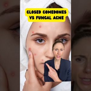 1766667322 maxresdefault