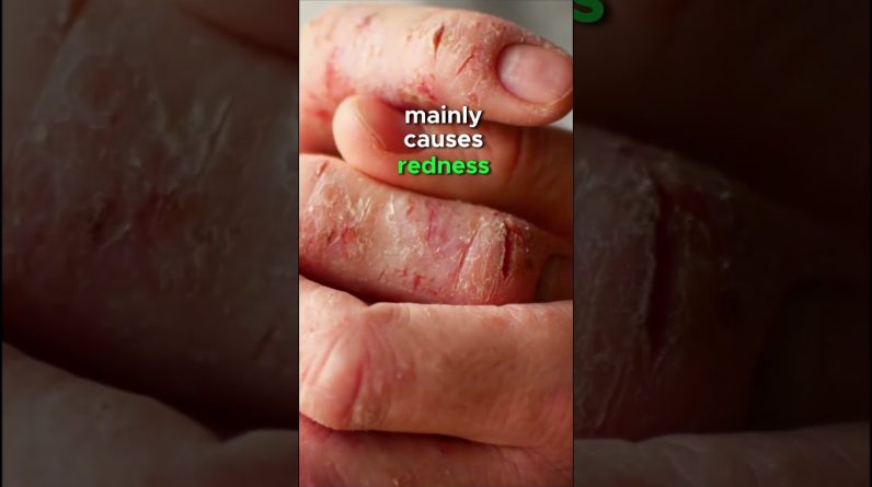 1766674675 maxresdefault