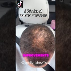 1766763845 maxresdefault