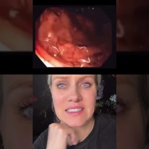 1766780871 maxresdefault