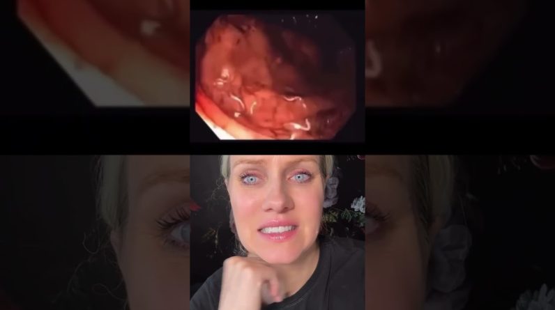 1766780871 maxresdefault