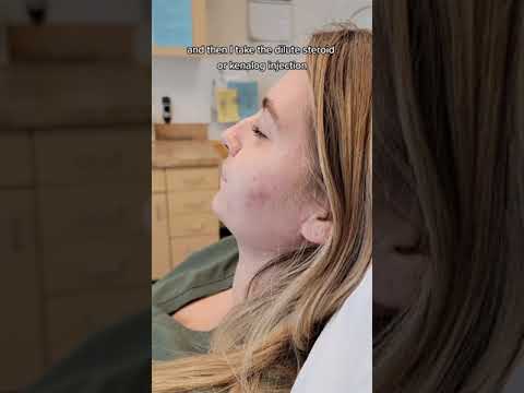 1766788186 hqdefault