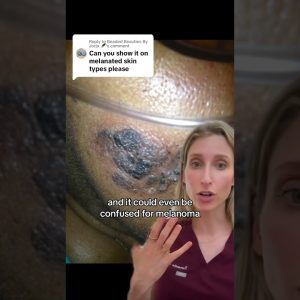 1766791845 maxresdefault