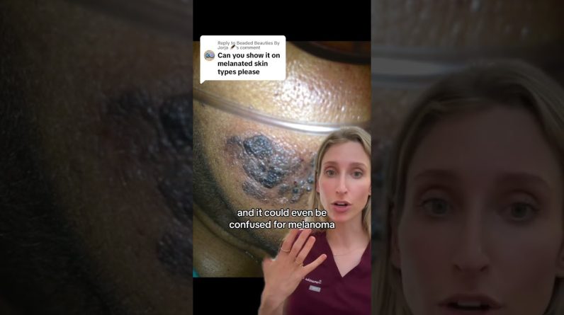 1766791845 maxresdefault