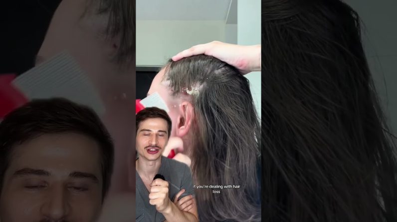 1766795503 maxresdefault