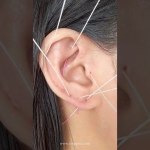 1766833391 maxresdefault