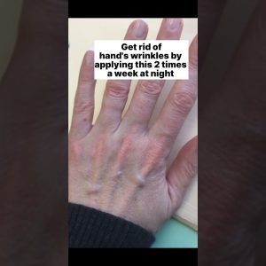 1766848123 maxresdefault