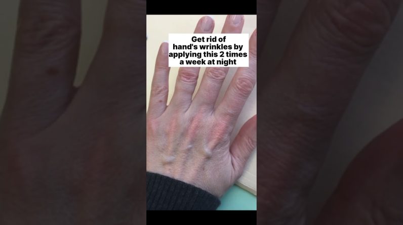 1766848123 maxresdefault