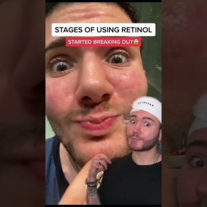 1766851665 maxresdefault