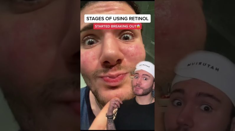 1766851665 maxresdefault