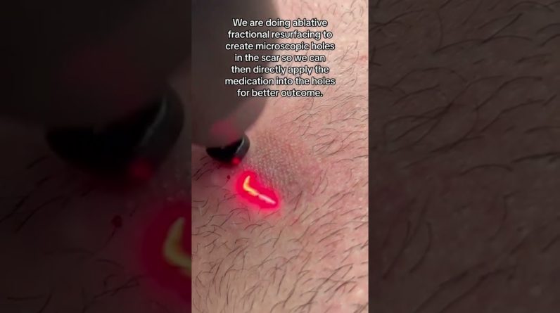 1766854131 maxresdefault