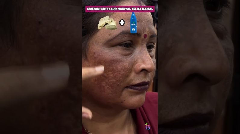 1766866427 maxresdefault