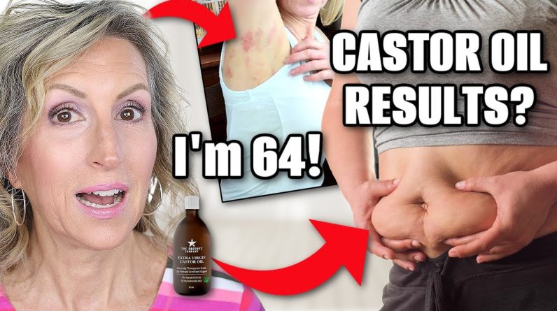 1766912804 maxresdefault