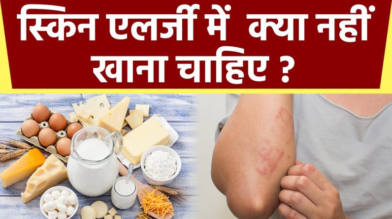 1766921384 maxresdefault