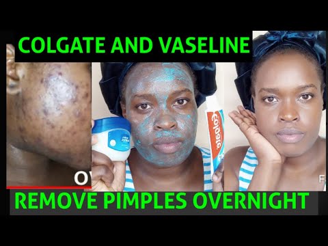 1766925051 hqdefault