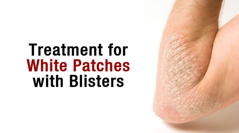 1766996985 maxresdefault