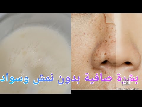 1767000776 hqdefault