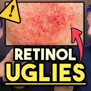 1767026263 maxresdefault