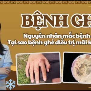 1767088545 maxresdefault