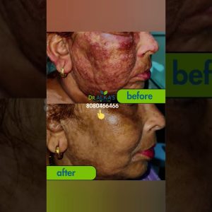 1767264585 maxresdefault