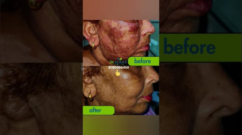 1767264585 maxresdefault