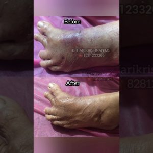 1767290203 maxresdefault