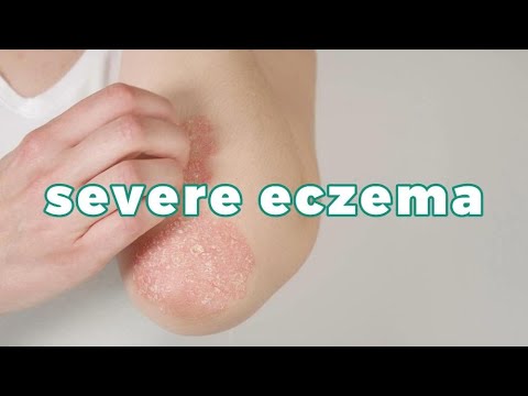 1767616475 hqdefault