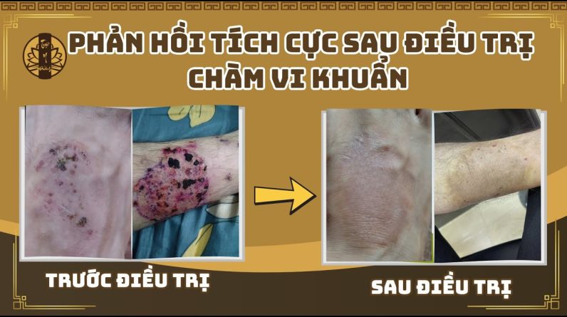 1767632393 maxresdefault