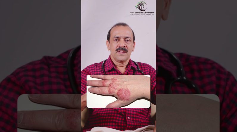 1767634927 maxresdefault