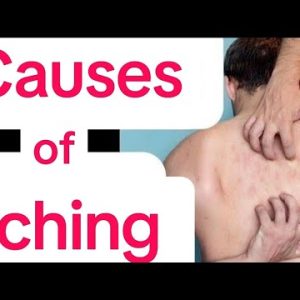 1767687284 hqdefault