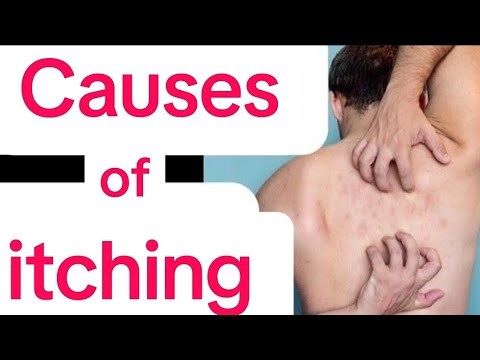 1767687284 hqdefault