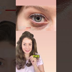 1767701584 maxresdefault