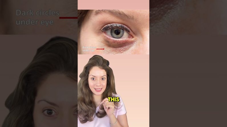 1767701584 maxresdefault